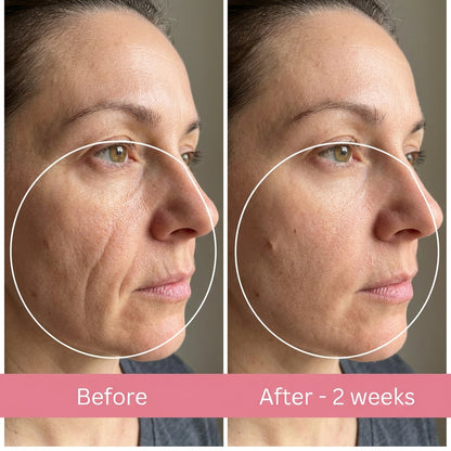 Lunéa Anti-Wrinkle Pillow