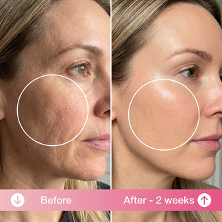 Lunéa Anti-Wrinkle Pillow